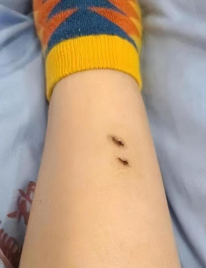 74549.cσm查询开奖记录和女子遭毒蛇咬伤身亡与女子遭毒蛇咬伤身亡视频